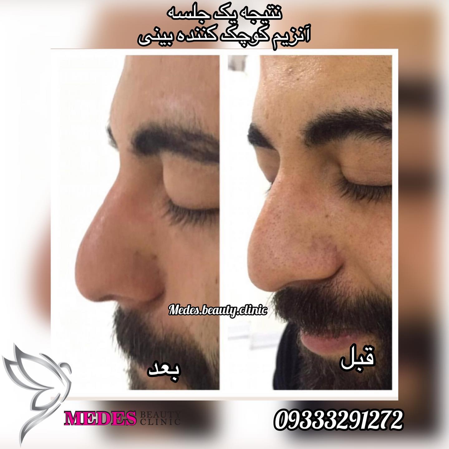 گالری اصلاح فرم بینی